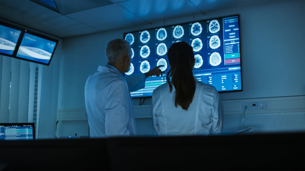 Médico apontando para monitor médico exibindo imagens cerebrais e médica observando