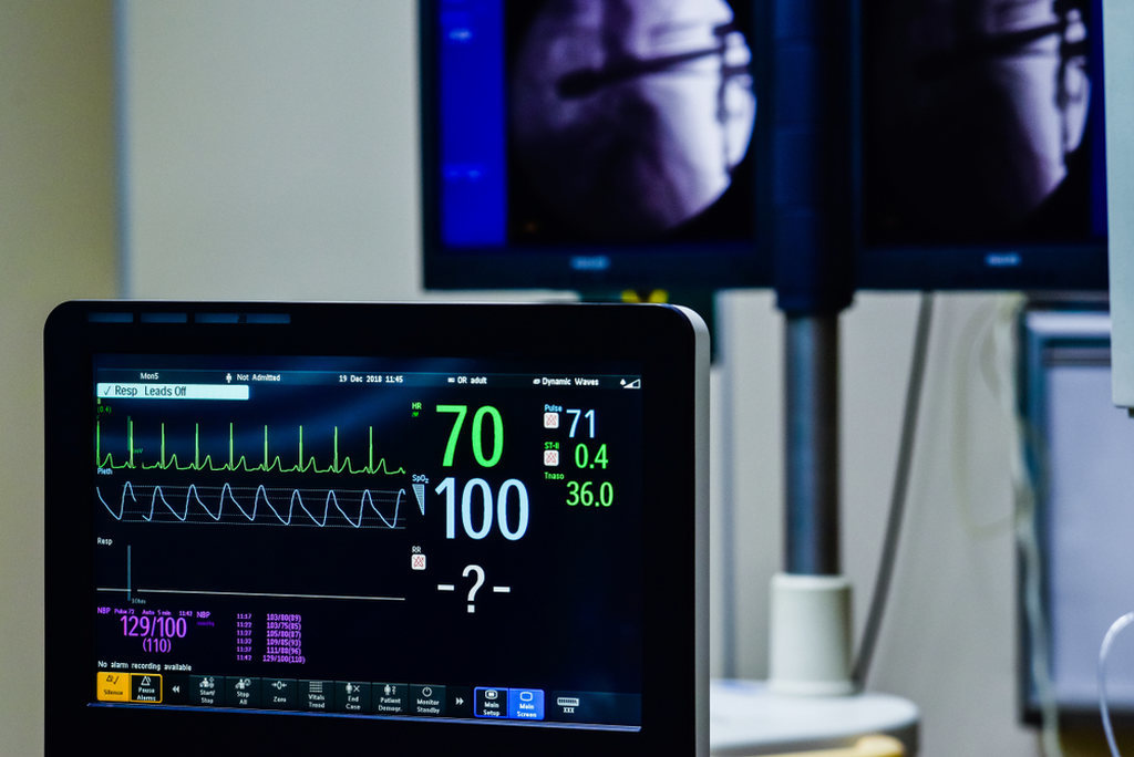 Monitor médico exibindo frequência cardíaca e pressão arterial